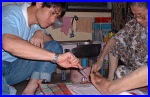 แผลเบาหวาน เชลล์ฟู้ด