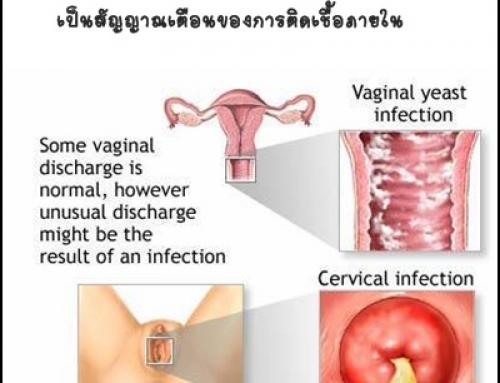 อาการตกขาว บ่งบอกปัญหาจุดซ่อนเร้นได้